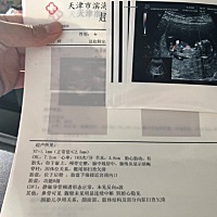 之前拍的NT都有形状了哈哈，男宝女宝都是我的宝宝哈哈哈，不过也很好奇他是个女孩子还是男孩子呢，第一...