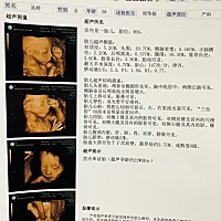 帮忙看男女，嘻嘻