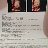 今天四维一次性通过😊😊，不知道是弟弟还是妹妹😊😊