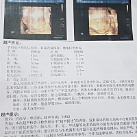 像男宝宝还是女宝宝   好奇😂