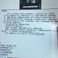 宝贝让你再住两天，不赶紧发动麻麻也要催你出来见面了哈！