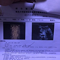 有没有跟我一样的24周➕6，说脐动脉血流值稍高