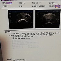有没有看得懂的呀。这个时候我应该怀孕多少天了呢？好着急呀。预产期不知道什么时候。