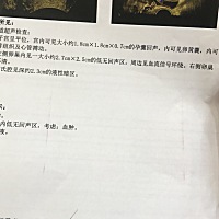 昨天去做了怀孕以来得第一次B超，医生说一切都好！