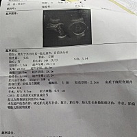 上次检查说侧脑室有点稍宽  这次又去复查了还是一样的 没有增宽也没有减少   医生叫我一直观察起没得太...