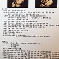 四维彩超，好奇，宝妈们看看男孩女孩