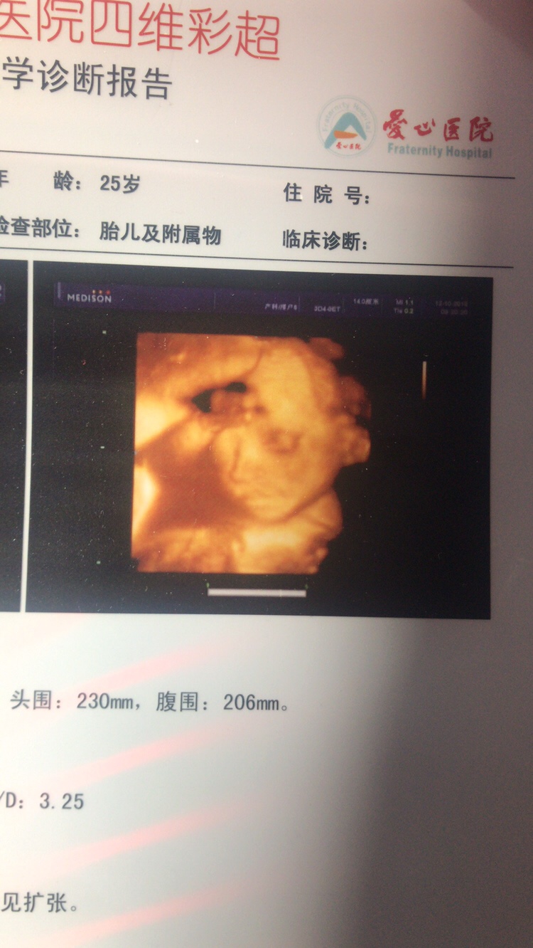 好清晰 已经知道男孩女孩 宝妈们猜一下 看着像男孩还是女孩