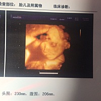 好清晰 已经知道男孩女孩 宝妈们猜一下 看着像男孩还是女孩