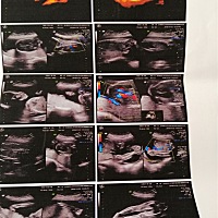 有没有人帮忙看下男孩女孩？