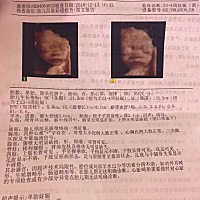 四维过了，但是胎心一会快一会慢，好担心，有没有宝妈一样的？