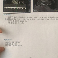 今天做NT值4.5。我的妈呀、怎么办、都不知道怎么弄好了