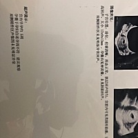 我慌了 今天去医院检查 我10月8日 来的最后一次月经 来了7天 15号月经走的 算得日子得有将近60天多了 还...