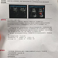 七个多月检查是女孩，九个多月问单子也是偏女的，😂😂，一直以为是男的，准备的也差不多都是蓝色衣...