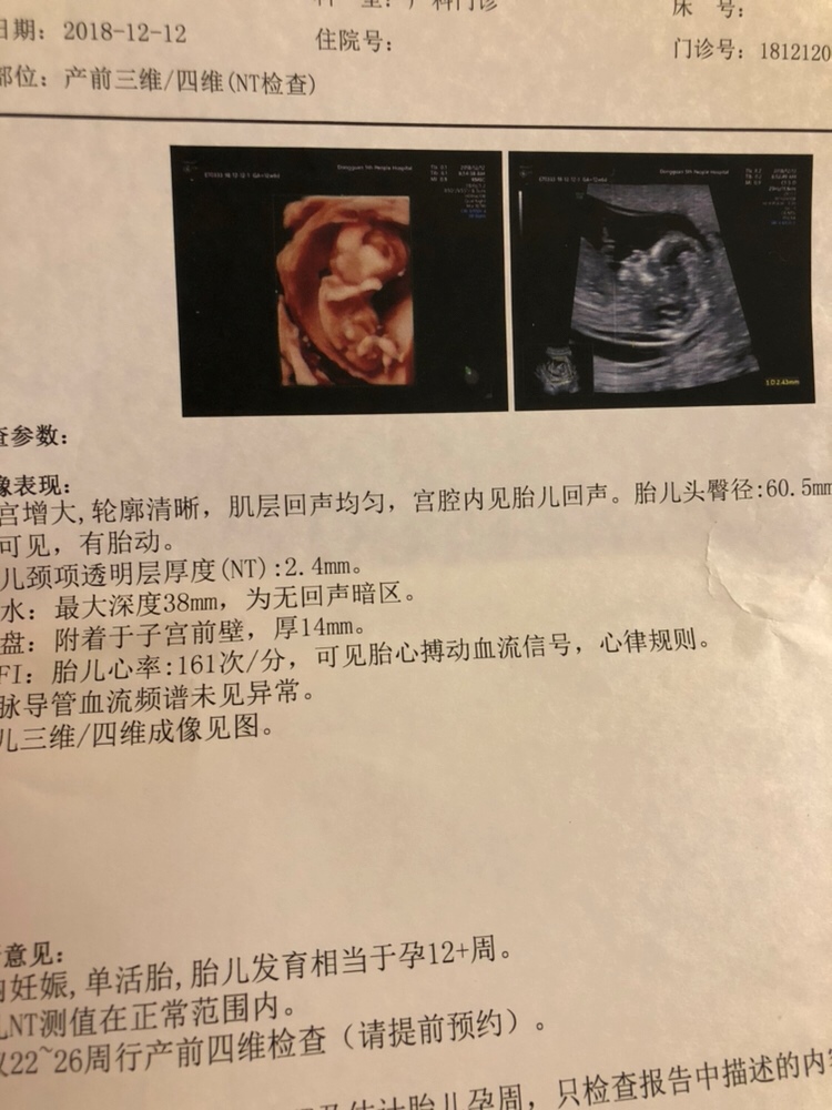 12周➕6可以看出性别了吗