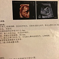 12周➕6可以看出性别了吗 12周➕6可以看出性别了吗