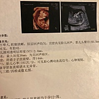 12周➕6可以看出性别了吗