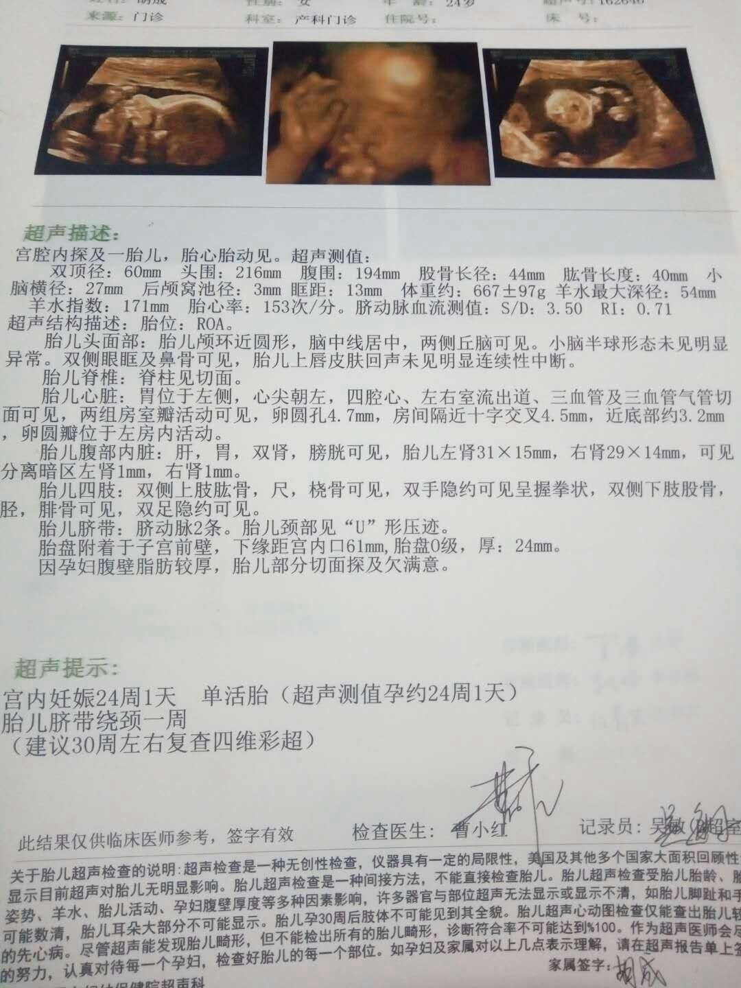 为莫别人的那么清楚，我的这个样子，看都看不清，真的是赘肉多了