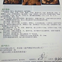 四维 为莫别人的那么清楚，我的这个样子，看都看不清，真的是赘肉多了