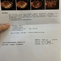 未次10.30，11月4日结束。11月24日出了点血，以为姨妈来了，垫了个护垫后再也没见血。期间肚子偶尔隐隐...