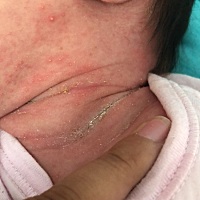 今天十八天了。想问下新生儿脖子腋窝大腿根怎么护理。没婆婆，愣头青一个。求解答！