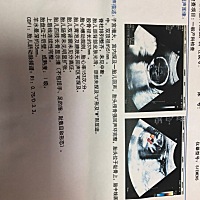 有没有宝妈会看彩超大排畸的单子？帮忙看下男女哈，二胎，纯属好奇，不喜勿喷！