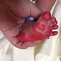 终于把这坨怀了十个多月会呼吸的 “陈年粑粑”给拉了出来，过程太酸爽了，有撕裂，12月13号下午14:3...