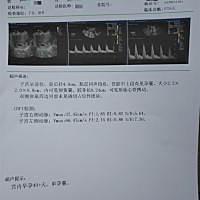 3月份去泰国做试管，10月份移植一次成功，宝贝已经出胎心胎芽了，好开心。现在已经有12周了，好期待宝宝...