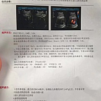 怎么感觉这软件的宝妈生男的多，身边朋友也是男的，看着人家男宝宝好可爱，也想要个男的，去检查是女的...