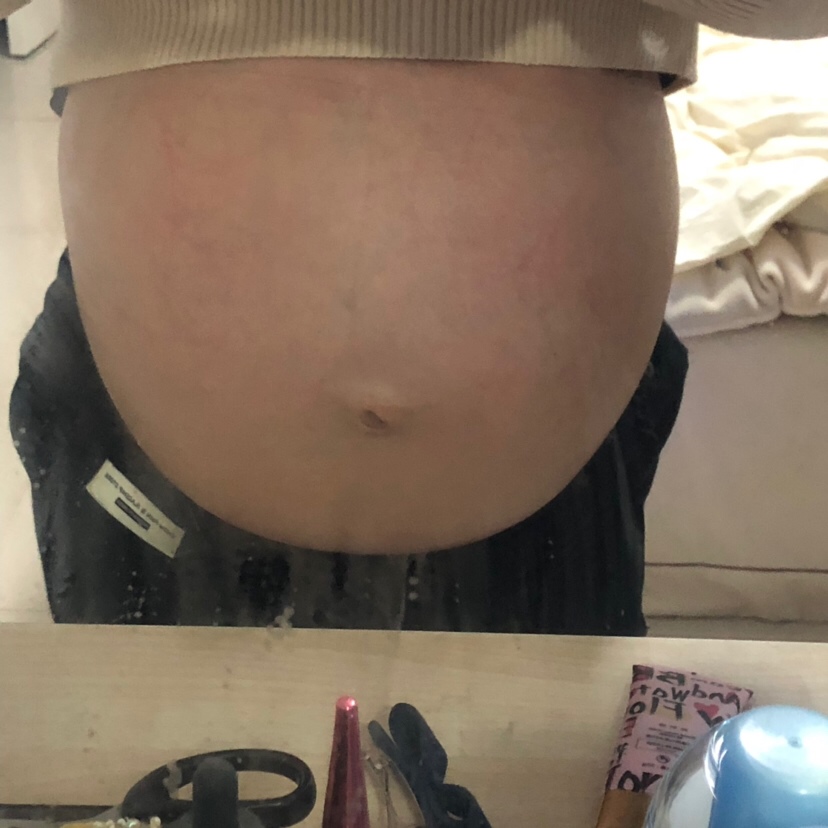 开始肚子都很大 还不到七个月呢、六个半月 ，。