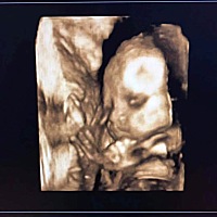 大家帮看看我家男宝，像我们两个谁！