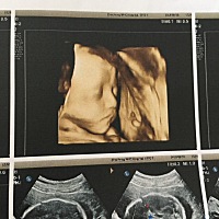 眼看着预产期，还没发动，你咋那么淡定呢宝👶，外面的世界很精彩，出来看看吧……