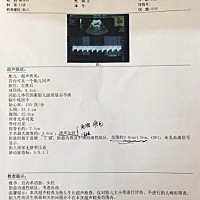 今天足月了😄开心，有没懂的人看这个数据顺产的话好不好生，就怕娃娃头大了。问医生说有3050g了，6斤...