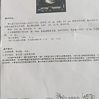 38周双径顶95 体重六斤八 还能顺便吗 大头正常吗