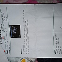 有谁像我这样用验孕棒测了两次都怀了，去医院却检查不出来