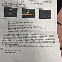 怀孕快八个月了 今天去产检B超单上写着胎儿面部不清是怎么回事 之前做四维的时候医生也没说什么啊