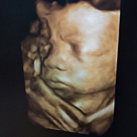 猜猜是女宝还是男宝