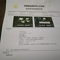 帮忙看男女  预产期在2.27