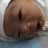 我家宝宝一个眼睛眼屎特别多，这怎么回事？