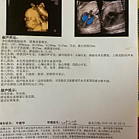 倒计时，每天都是数着过日子，好期待小宝贝