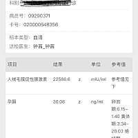 这是五周➕1的结果 感觉还可以 现在五周➕4了 今天一整天左侧挨着骨头的地方时不时抽痛 是什么意思