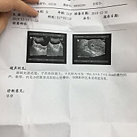 42天，测出来胎心了，心里终于踏实了，希望宝宝健康长大，多一个月再去检查下