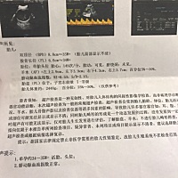 好想知道是男宝还是女宝