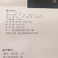 臀位，绕颈二圈，羊水偏多，真是吐血了[流泪]