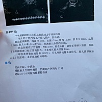 有经验的妈妈帮我看看是男宝宝还是女宝宝？