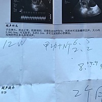 第一次做b超 留念 好奇宝宝是男是女