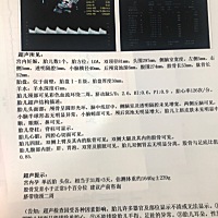 各位孕妈，我现在孕32周了。可是宝宝的股骨只有530mm.肱骨就已经有520mm的了。医生说我家宝宝腿太短了，...