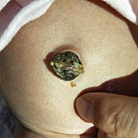 18天了宝宝的肚脐还没掉好担心有没有有经验的宝妈