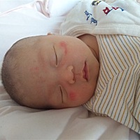 宝宝20天了，小脸变成这样了，怎么回事有知道的吗