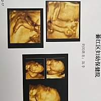 昨天照的四维 谁能看懂？