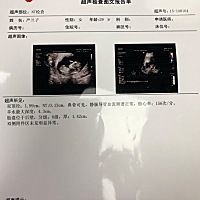 今天做了胎儿NT检查，13周➕1天 宝宝发育很好，宝妈们可以看出是男宝还是女包阿，嘿嘿